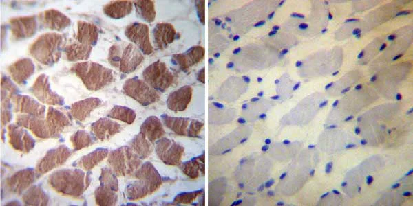 Immunohistochemistry (Formalin/PFA-fixed paraffin-embedded sections) - Anti-Hsp27 antibody (AB5579)