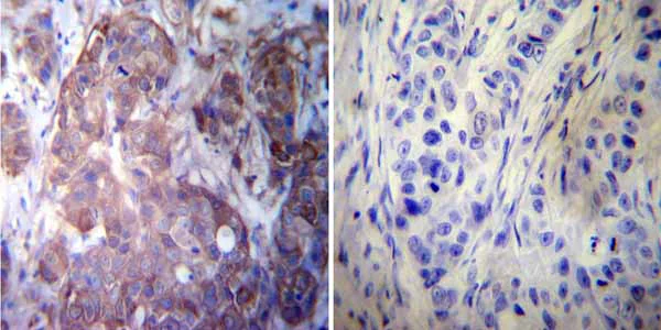 Immunohistochemistry (Formalin/PFA-fixed paraffin-embedded sections) - Anti-Hsp27 antibody (AB5579)