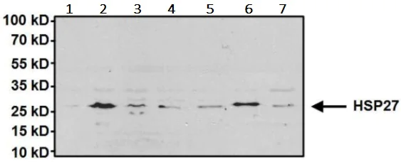 Western blot - Anti-Hsp27 antibody (AB5579)