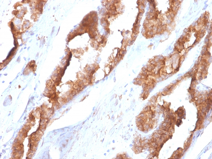 Immunohistochemistry (Formalin/PFA-fixed paraffin-embedded sections) - Anti-Hsp27 antibody [CPTC-HSPB1-2] (AB268073)