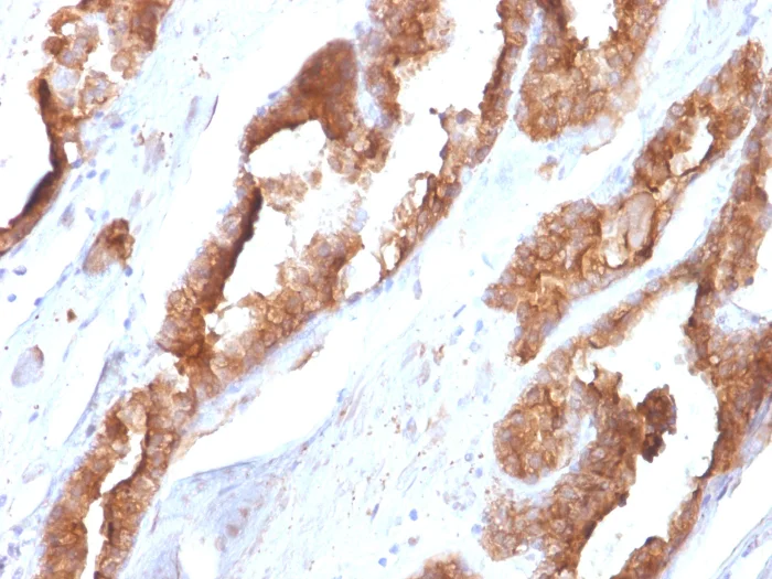 Immunohistochemistry (Formalin/PFA-fixed paraffin-embedded sections) - Anti-Hsp27 antibody [CPTC-HSPB1-2] (AB268073)