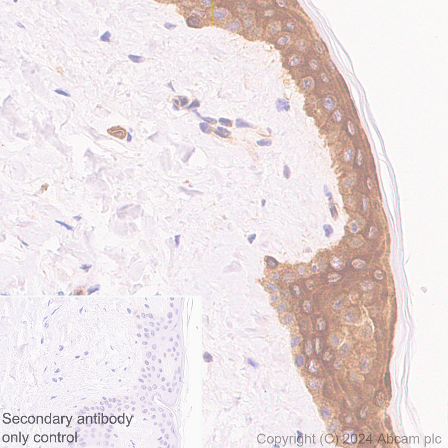 Immunohistochemistry (Formalin/PFA-fixed paraffin-embedded sections) - Anti-Hsp27 antibody [EP1724Y] (AB62339)