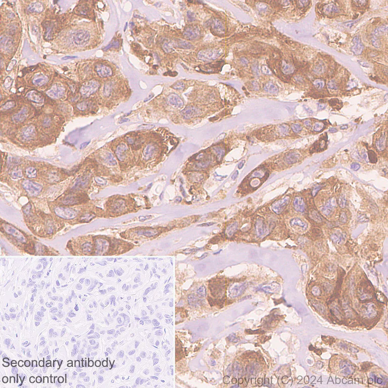 Immunohistochemistry (Formalin/PFA-fixed paraffin-embedded sections) - Anti-Hsp27 antibody [EP1724Y] - BSA and Azide free (AB247352)