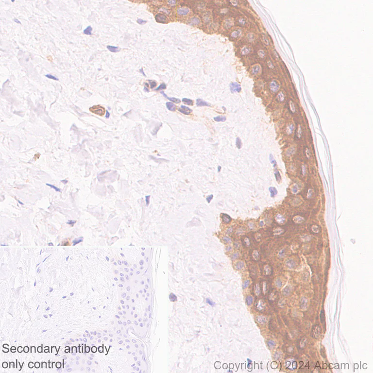 Immunohistochemistry (Formalin/PFA-fixed paraffin-embedded sections) - Anti-Hsp27 antibody [EP1724Y] - BSA and Azide free (AB247352)