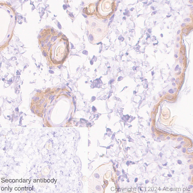 Immunohistochemistry (Formalin/PFA-fixed paraffin-embedded sections) - Anti-Hsp27 antibody [EP1724Y] - BSA and Azide free (AB247352)