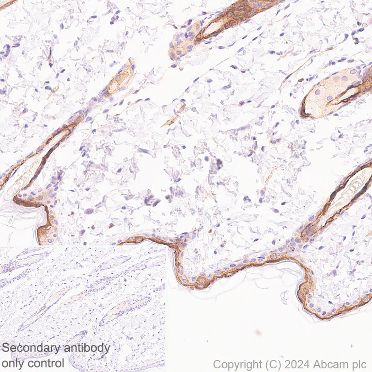 Immunohistochemistry (Formalin/PFA-fixed paraffin-embedded sections) - Anti-Hsp27 antibody [EP1724Y] - BSA and Azide free (AB247352)