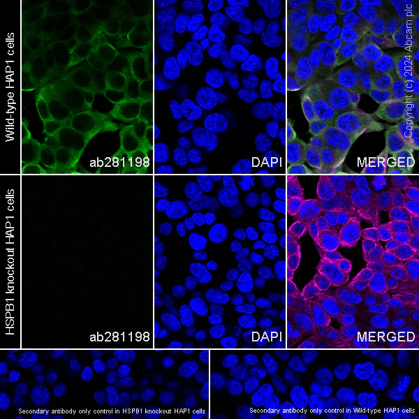 Immunocytochemistry/ Immunofluorescence - Anti-Hsp27 antibody [EPR23938-256] - BSA and Azide free (Capture) (AB281198)