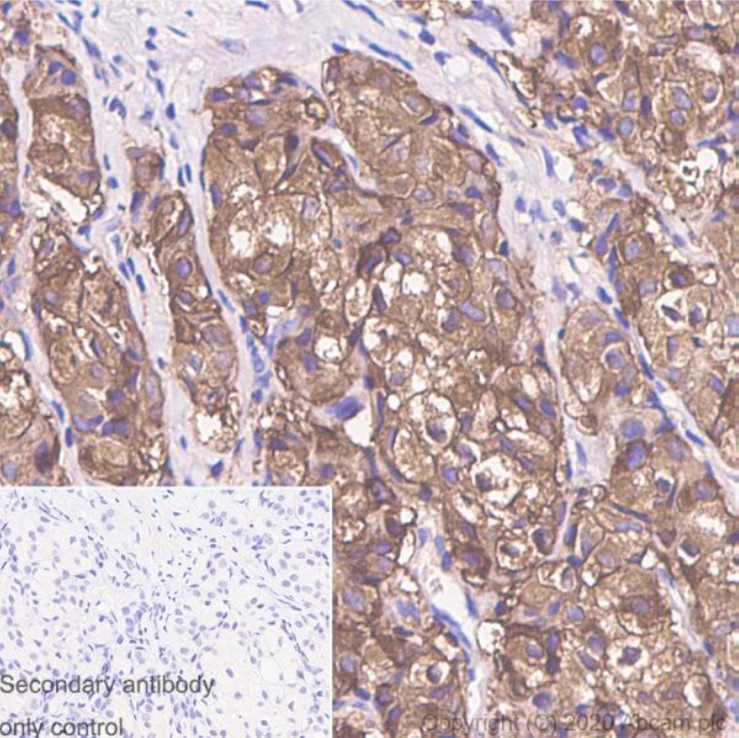 Immunohistochemistry (Formalin/PFA-fixed paraffin-embedded sections) - Anti-Hsp27 antibody [G3.1] (AB2790), expandable thumbnail
