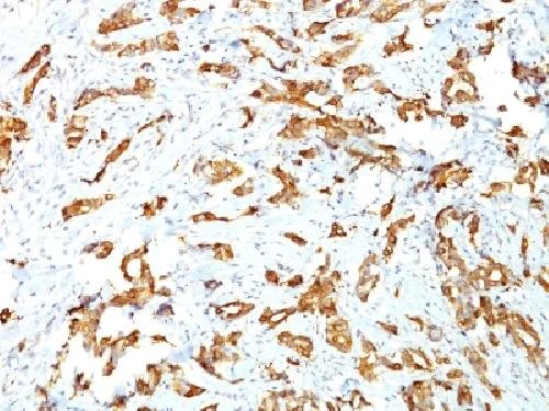 Immunohistochemistry (Formalin/PFA-fixed paraffin-embedded sections) - Anti-Hsp27 antibody [G3.1] - BSA and Azide free (AB212451)
