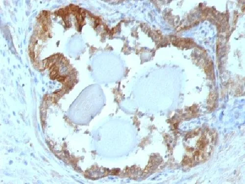 Immunohistochemistry (Formalin/PFA-fixed paraffin-embedded sections) - Anti-Hsp27 antibody [G3.1] - BSA and Azide free (AB212451)