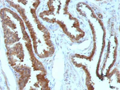 Immunohistochemistry (Formalin/PFA-fixed paraffin-embedded sections) - Anti-Hsp27 antibody [HSPB1/774] - BSA and Azide free (AB212453)