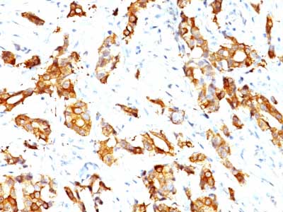 Immunohistochemistry (Formalin/PFA-fixed paraffin-embedded sections) - Anti-Hsp27 antibody [HSPB1/774] - BSA and Azide free (AB212453)
