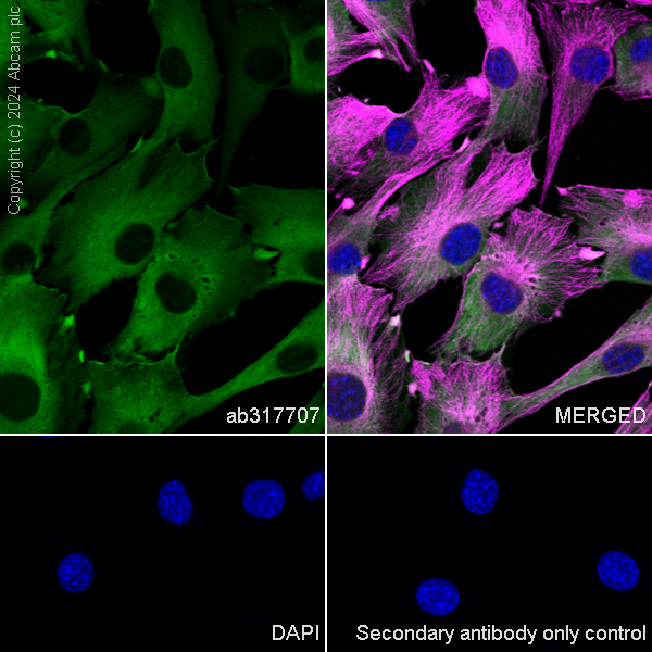 Immunocytochemistry/ Immunofluorescence - Anti-Hsp27 antibody [RM1148] (ab317707), expandable thumbnail