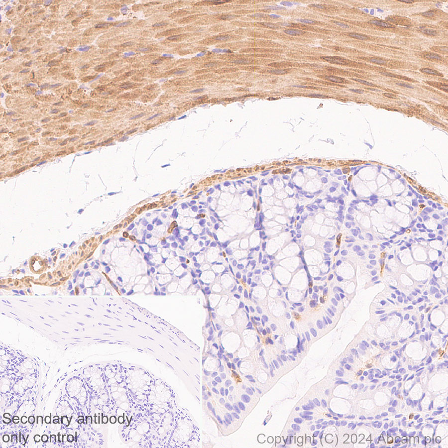 Immunohistochemistry (Formalin/PFA-fixed paraffin-embedded sections) - Anti-Hsp27 antibody [RM1148] (ab317707), expandable thumbnail
