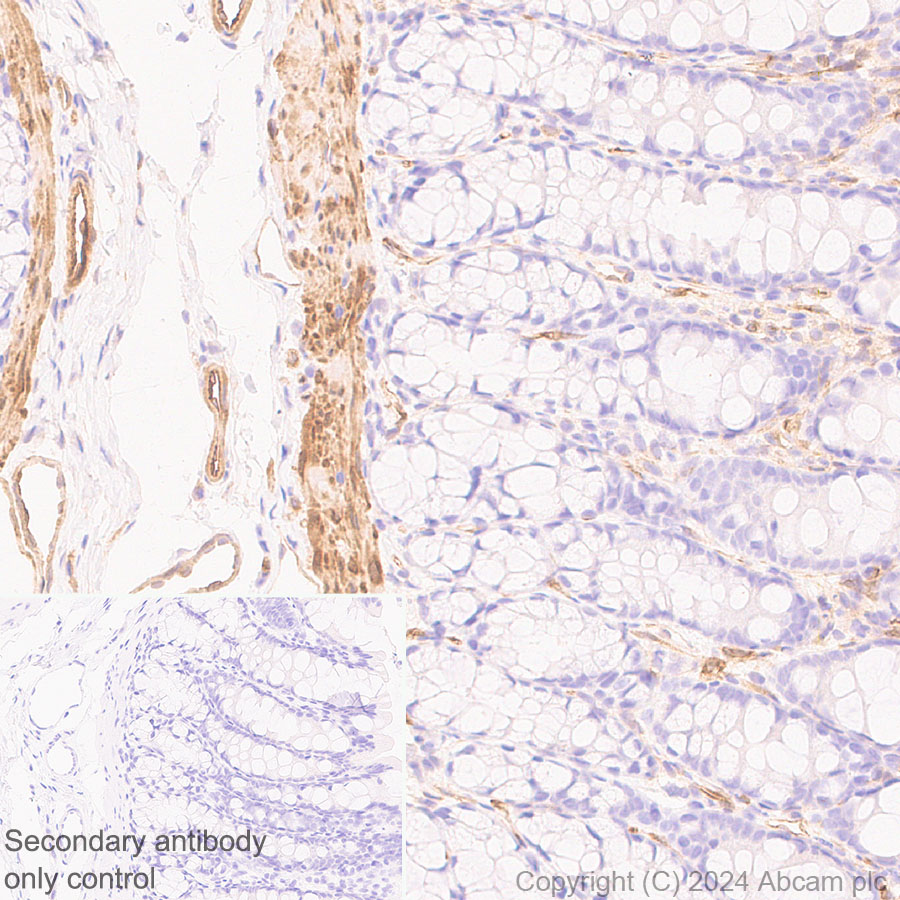 Immunohistochemistry (Formalin/PFA-fixed paraffin-embedded sections) - Anti-Hsp27 antibody [RM1148] (ab317707), expandable thumbnail