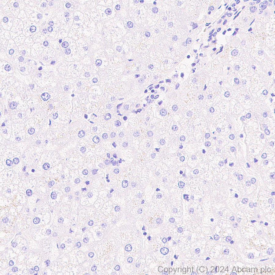 Immunohistochemistry (Formalin/PFA-fixed paraffin-embedded sections) - Anti-Hsp27 antibody [RM1148] (ab317707), expandable thumbnail
