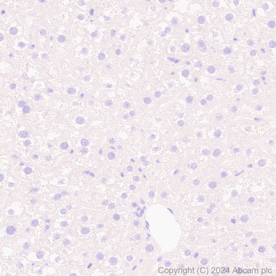Immunohistochemistry (Formalin/PFA-fixed paraffin-embedded sections) - Anti-Hsp27 antibody [RM1148] (ab317707), expandable thumbnail