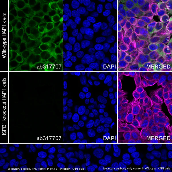 Immunocytochemistry/ Immunofluorescence - Anti-Hsp27 antibody [RM1148] - BSA and Azide free (AB317708)