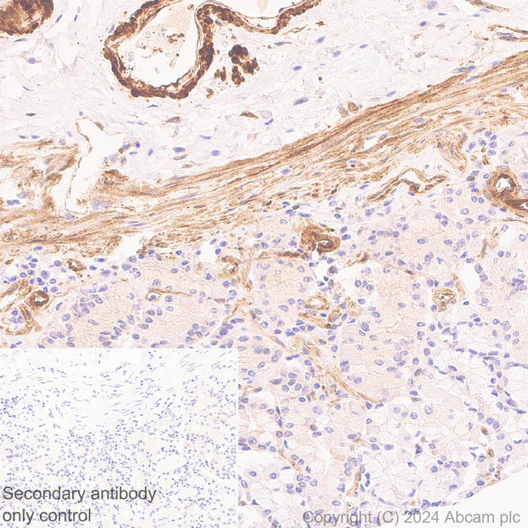 Immunohistochemistry (Formalin/PFA-fixed paraffin-embedded sections) - Anti-Hsp27 antibody [RM1148] - BSA and Azide free (AB317708)