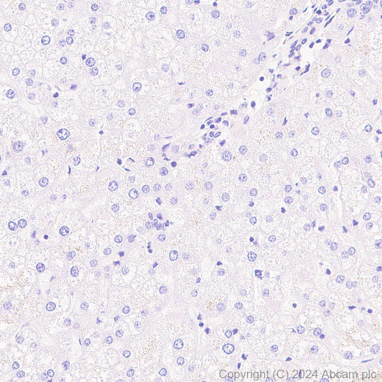 Immunohistochemistry (Formalin/PFA-fixed paraffin-embedded sections) - Anti-Hsp27 antibody [RM1148] - BSA and Azide free (AB317708)