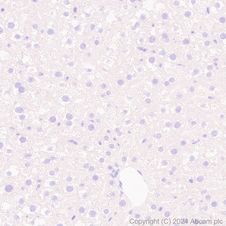 Immunohistochemistry (Formalin/PFA-fixed paraffin-embedded sections) - Anti-Hsp27 antibody [RM1148] - BSA and Azide free (AB317708)