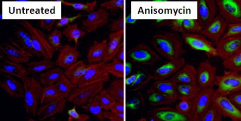 Immunocytochemistry/ Immunofluorescence - Anti-Hsp27 (phospho S15) antibody (AB5581)