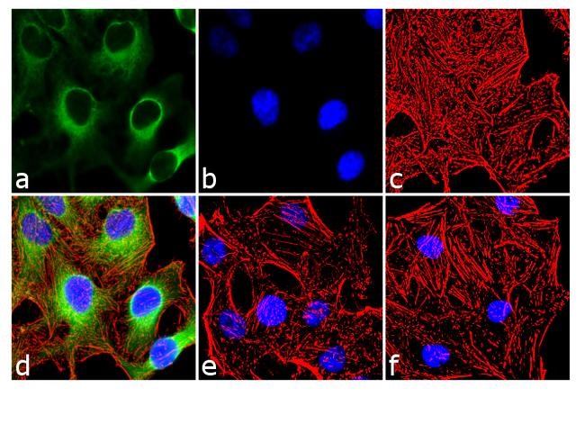 Immunocytochemistry/ Immunofluorescence - Anti-Hsp27 (phospho S15) antibody (AB5581)