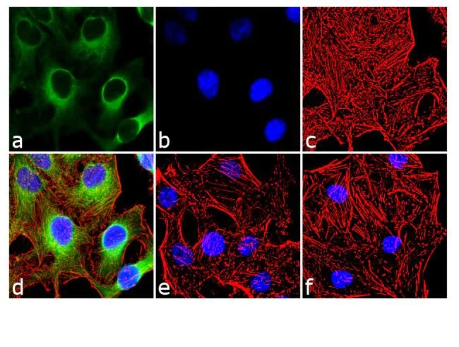 Immunocytochemistry/ Immunofluorescence - Anti-Hsp27 (phospho S15) antibody (AB5581)