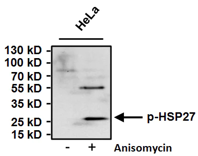 Western blot - Anti-Hsp27 (phospho S15) antibody (AB5581)