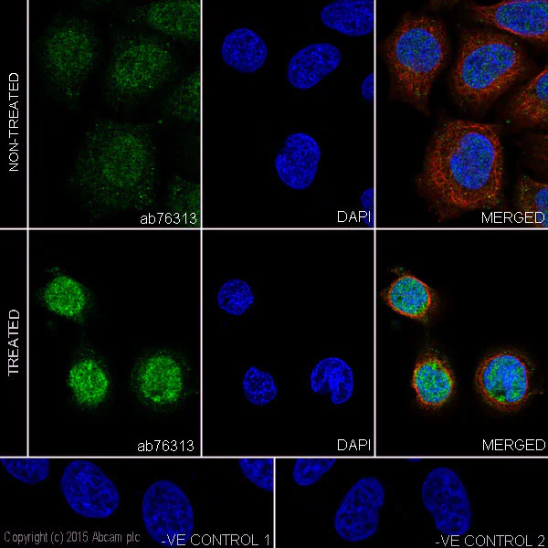 Immunocytochemistry/ Immunofluorescence - Anti-Hsp27 (phospho S15) antibody [EP2293Y] (AB76313)