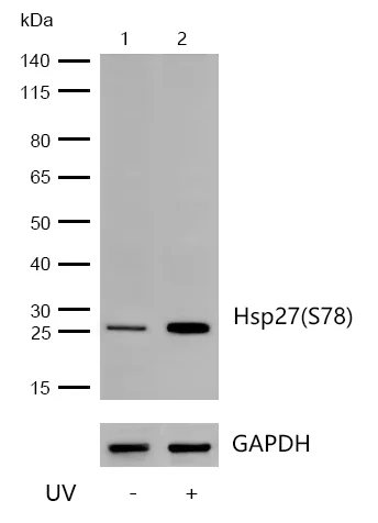 Western blot - Anti-Hsp27 (phospho S78) antibody [JJ08-70] (AB326634)