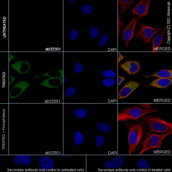 Immunocytochemistry/ Immunofluorescence - Anti-Hsp27 (phospho S78) antibody [Y175] - BSA and Azide free (AB247262)