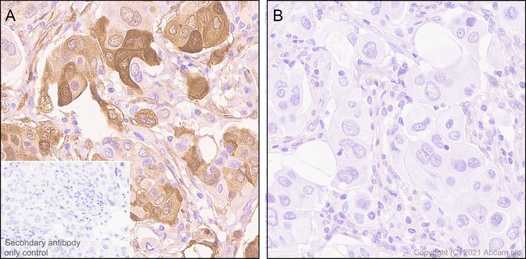 Immunohistochemistry (Formalin/PFA-fixed paraffin-embedded sections) - Anti-Hsp27 (phospho S78) antibody [Y175] - BSA and Azide free (AB247262)