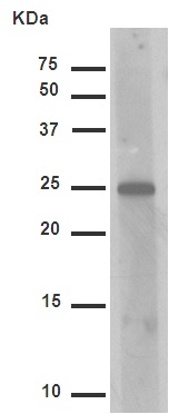 Western blot - Anti-Hsp27 (phospho S82) antibody [EPR7278] (ab155987), expandable thumbnail
