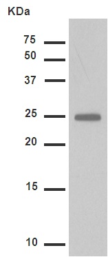 Western blot - Anti-Hsp27 (phospho S82) antibody [EPR7278] (AB155987), expandable thumbnail