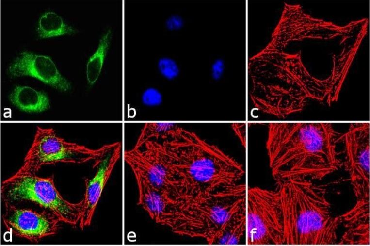 Immunocytochemistry - Anti-Hsp27 (phospho S86) antibody (AB17938)