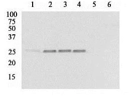 Western blot - Anti-Hsp27 (phospho S86) antibody (AB17938)