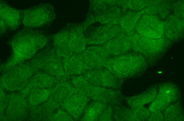 Immunocytochemistry/ Immunofluorescence - Anti-Hsp40 antibody [3B9.E6] (AB223607)