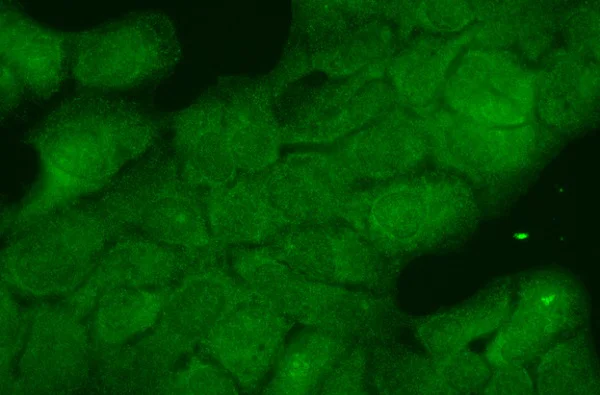 Immunocytochemistry/ Immunofluorescence - Anti-Hsp40 antibody [3B9.E6] (AB223607)