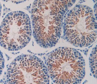 Immunohistochemistry (Formalin/PFA-fixed paraffin-embedded sections) - Anti-Hsp40 antibody (AB231577)