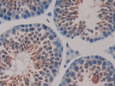 Immunohistochemistry (Formalin/PFA-fixed paraffin-embedded sections) - Anti-Hsp40 antibody (AB231577)