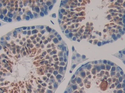 Immunohistochemistry (Formalin/PFA-fixed paraffin-embedded sections) - Anti-Hsp40 antibody (AB231577)