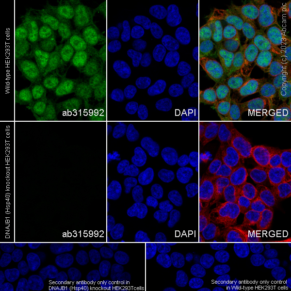 Immunocytochemistry/ Immunofluorescence - Anti-Hsp40 antibody [EPR25331-69] - BSA and Azide free (ab315993), expandable thumbnail