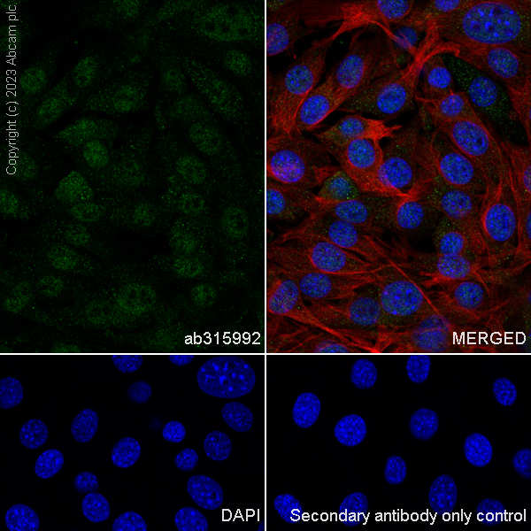 Immunocytochemistry/ Immunofluorescence - Anti-Hsp40 antibody [EPR25331-69] - BSA and Azide free (ab315993), expandable thumbnail