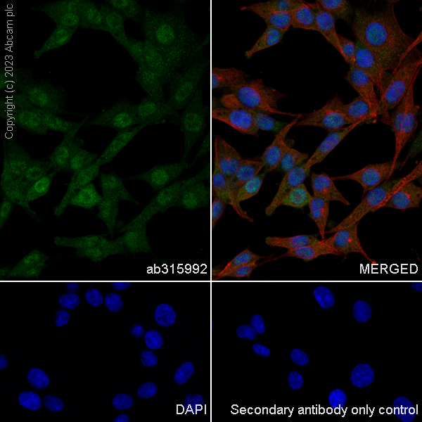 Immunocytochemistry/ Immunofluorescence - Anti-Hsp40 antibody [EPR25331-69] - BSA and Azide free (ab315993), expandable thumbnail