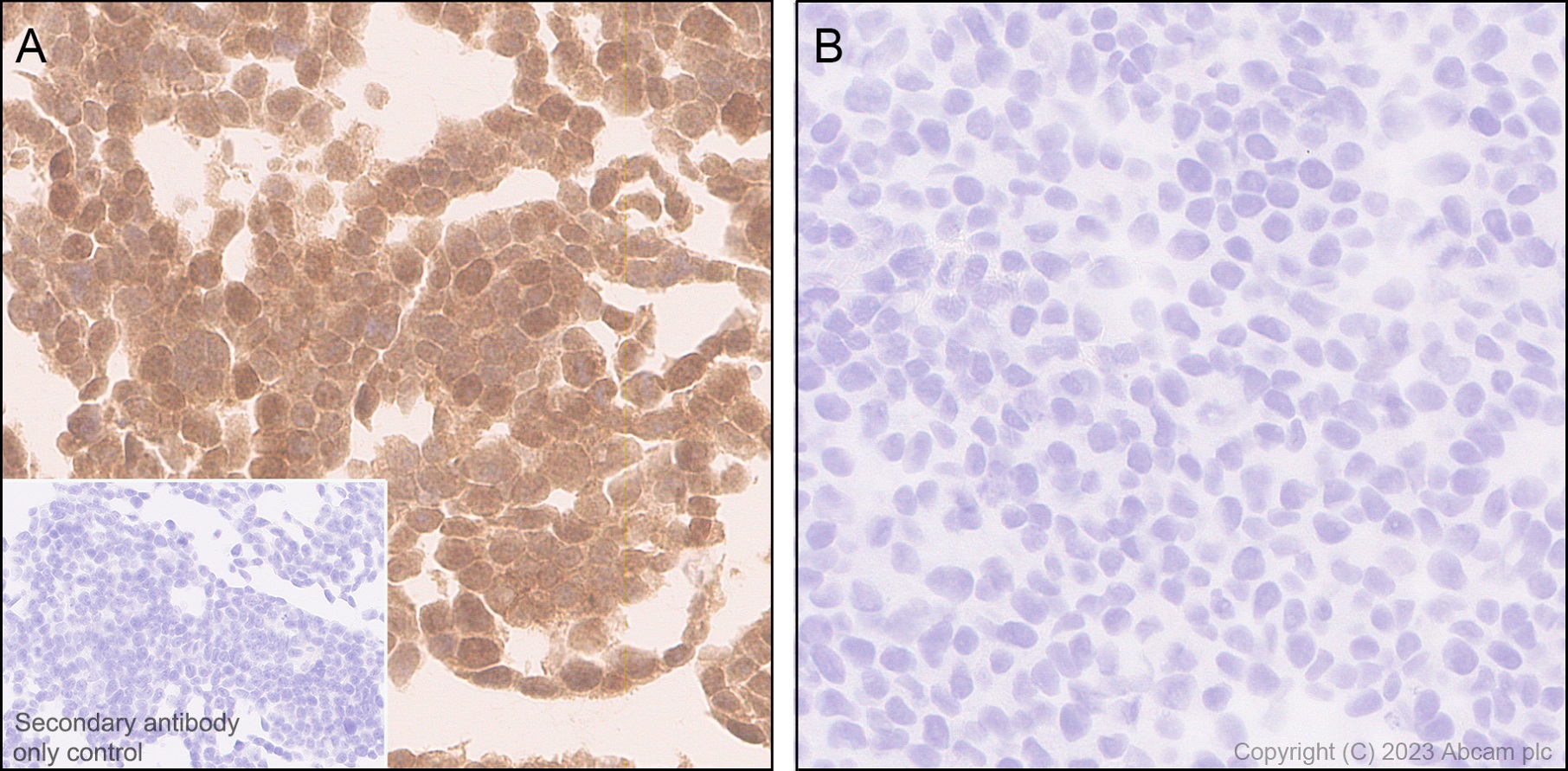 Immunohistochemistry (Formalin/PFA-fixed paraffin-embedded sections) - Anti-Hsp40 antibody [EPR25331-69] - BSA and Azide free (ab315993), expandable thumbnail