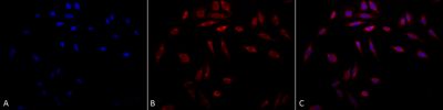 Immunocytochemistry/ Immunofluorescence - Anti-Hsp47 antibody [1C4-1A6] (AB242006), expandable thumbnail