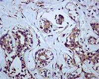 Immunohistochemistry (Formalin/PFA-fixed paraffin-embedded sections) - Anti-Hsp47 antibody [EPR4217] (AB109117)