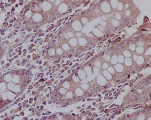 Immunohistochemistry (Formalin/PFA-fixed paraffin-embedded sections) - Anti-Hsp47 antibody [EPR4217] (AB109117)