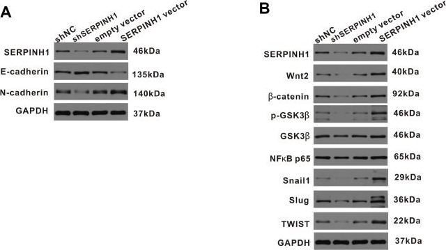Western blot - Anti-Hsp47 antibody [EPR4217] (ab109117), expandable thumbnail